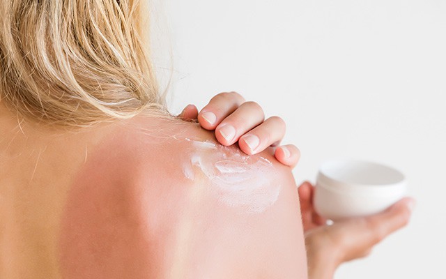 Sommer, Sonne, Sonnenschein: Vorsicht bei Sonnenbrand